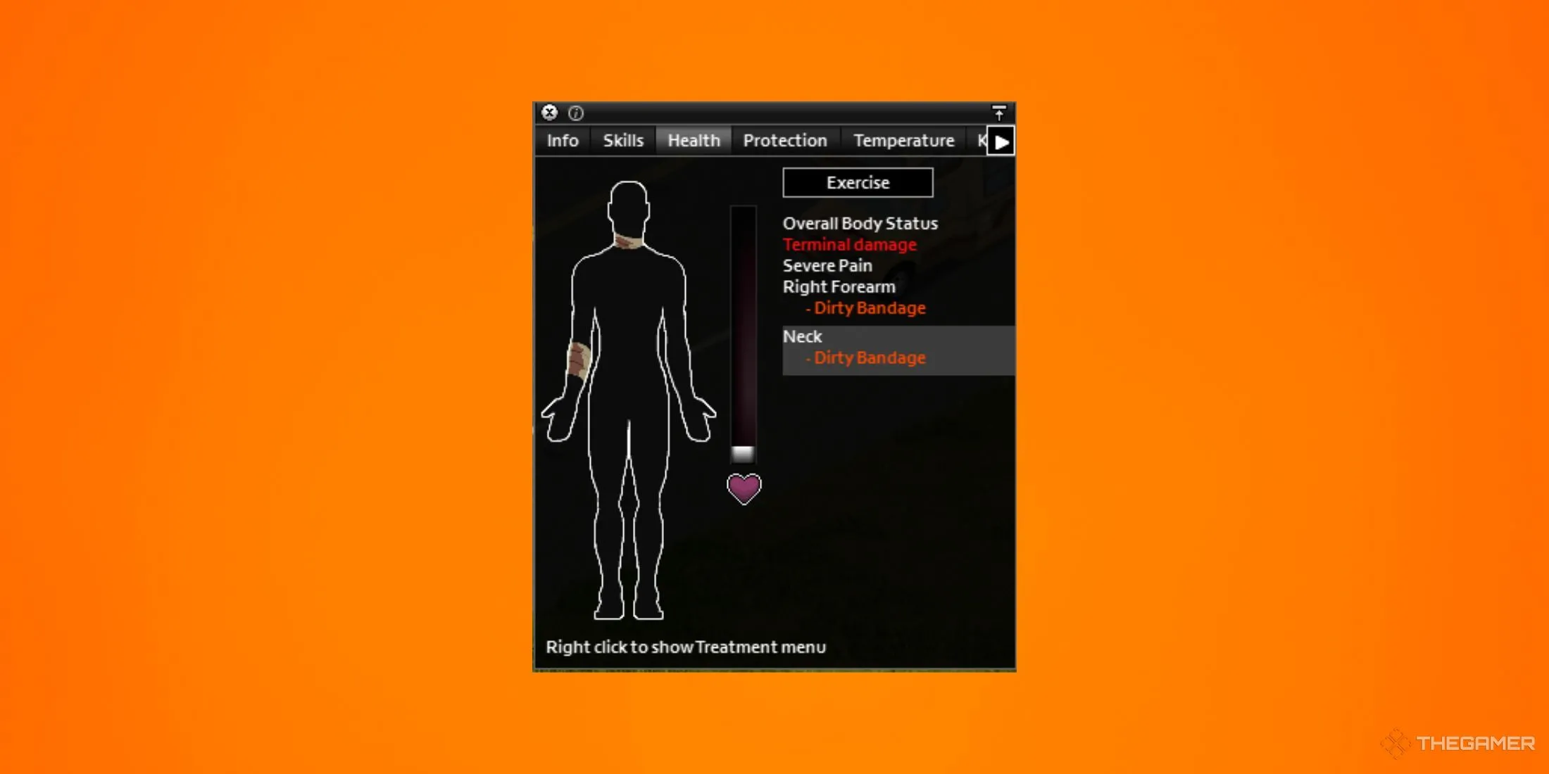 Băng gạc bẩn Dirty Bandage trong Project Zomboid gây nhiễm trùng nguy hiểm